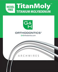 arcs et fils titanmoly titanium tma molybdenum orthodontie azur orthodontics