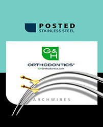 arcs et fils xr1 posted stainless steel orthodontie azur orthodontics